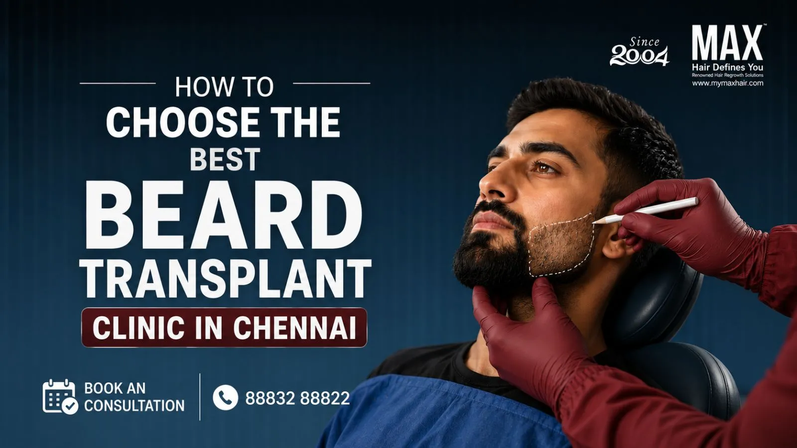 How to Choose the Best Beard Transplant Clinic in Chennai
